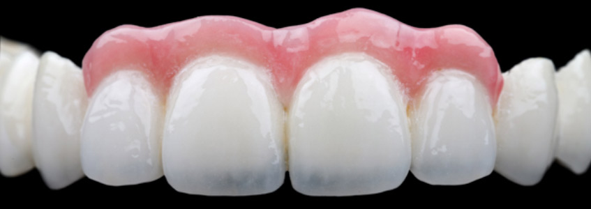 Prosthodontics